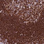 ABI3BP Antibody in Immunohistochemistry (Paraffin) (IHC (P))