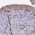 ABI3BP Antibody in Immunohistochemistry (Paraffin) (IHC (P))