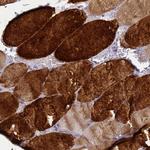 HSP20 Antibody in Immunohistochemistry (Paraffin) (IHC (P))