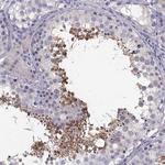 ADAM32 Polyclonal Antibody