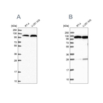 alanyl-tRNA Synthetase Antibody in Western Blot (WB)