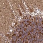 TRAP1 Antibody in Immunohistochemistry (Paraffin) (IHC (P))