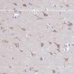 TID1 Antibody in Immunohistochemistry (Paraffin) (IHC (P))
