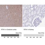 RTN1 Antibody