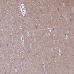 RTN1 Antibody in Immunohistochemistry (Paraffin) (IHC (P))