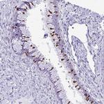 RTN1 Antibody in Immunohistochemistry (Paraffin) (IHC (P))