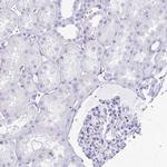 RTN1 Antibody in Immunohistochemistry (Paraffin) (IHC (P))