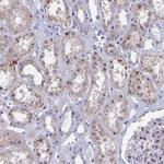 GTF2IRD1 Antibody in Immunohistochemistry (Paraffin) (IHC (P))