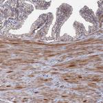 GTF2IRD1 Antibody in Immunohistochemistry (Paraffin) (IHC (P))