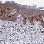 GTF2IRD1 Antibody in Immunohistochemistry (Paraffin) (IHC (P))