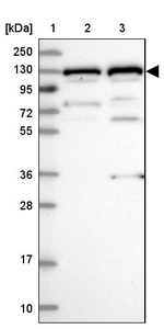 GTF2IRD1 Antibody in Western Blot (WB)