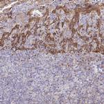 Golgin-97 Antibody in Immunohistochemistry (Paraffin) (IHC (P))