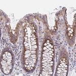 Golgin-97 Antibody in Immunohistochemistry (Paraffin) (IHC (P))