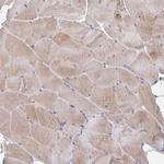 Golgin-97 Antibody in Immunohistochemistry (Paraffin) (IHC (P))