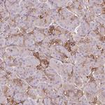 TSPAN8 Antibody in Immunohistochemistry (Paraffin) (IHC (P))