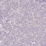 TSPAN8 Antibody in Immunohistochemistry (Paraffin) (IHC (P))