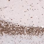 CIC Antibody in Immunohistochemistry (Paraffin) (IHC (P))