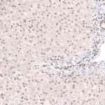 CIC Antibody in Immunohistochemistry (Paraffin) (IHC (P))