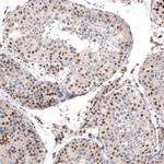 CIC Antibody in Immunohistochemistry (Paraffin) (IHC (P))
