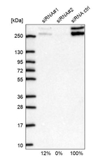 CIC Antibody in Western Blot (WB)