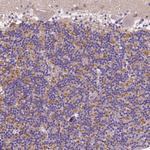 GABRD Polyclonal Antibody