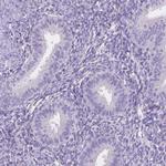 GABRD Antibody in Immunohistochemistry (Paraffin) (IHC (P))