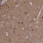 PKC epsilon Antibody in Immunohistochemistry (Paraffin) (IHC (P))