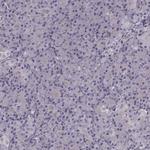 PKC epsilon Polyclonal Antibody
