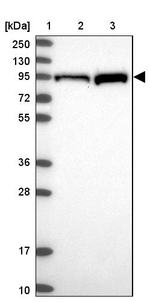 PKC epsilon Antibody in Western Blot (WB)