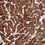 APC10 Antibody in Immunohistochemistry (Paraffin) (IHC (P))