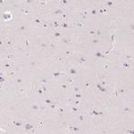 SFTPD Antibody in Immunohistochemistry (Paraffin) (IHC (P))
