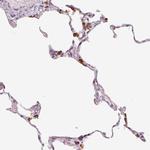SFTPD Antibody in Immunohistochemistry (Paraffin) (IHC (P))
