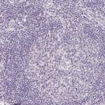 SFTPD Antibody in Immunohistochemistry (Paraffin) (IHC (P))