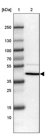 SFTPD Antibody in Western Blot (WB)
