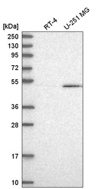 CUGBP1 Antibody in Western Blot (WB)