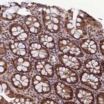 ARL2 Antibody in Immunohistochemistry (Paraffin) (IHC (P))