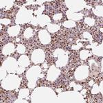 PU.1 Antibody in Immunohistochemistry (Paraffin) (IHC (P))