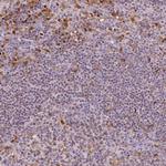 PU.1 Antibody in Immunohistochemistry (Paraffin) (IHC (P))