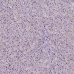 PU.1 Antibody in Immunohistochemistry (Paraffin) (IHC (P))