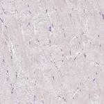 PU.1 Antibody in Immunohistochemistry (Paraffin) (IHC (P))