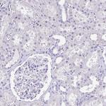 CD72 Antibody in Immunohistochemistry (Paraffin) (IHC (P))