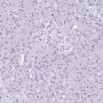 CD72 Antibody in Immunohistochemistry (Paraffin) (IHC (P))