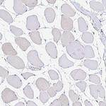 CD72 Antibody in Immunohistochemistry (Paraffin) (IHC (P))