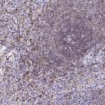 CD72 Antibody in Immunohistochemistry (Paraffin) (IHC (P))