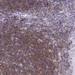 CD72 Antibody in Immunohistochemistry (Paraffin) (IHC (P))