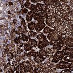 TCP10L Polyclonal Antibody