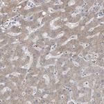 AKR1C4 Polyclonal Antibody