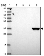AKR1C4 Antibody in Western Blot (WB)