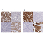 Cardiac Troponin C Antibody in Immunohistochemistry (Paraffin) (IHC (P))