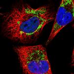 DLD Polyclonal Antibody